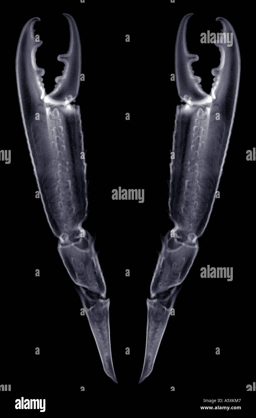 Röntgenaufnahme eines Poltinger paar Klauen (Nephrops Norvegicus). Radiographie de diesen de halbgar. Stockfoto