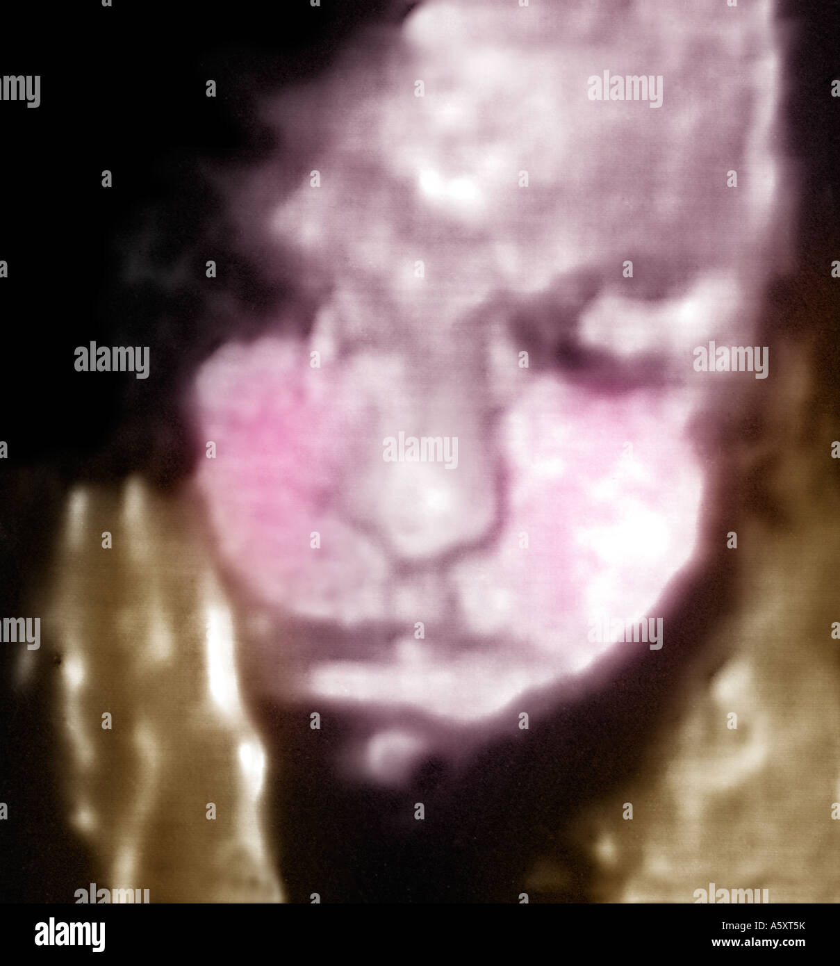 Drei dimensionale 3D Ultraschall von Gesicht und Hand eines menschlichen Fötus Stockfoto