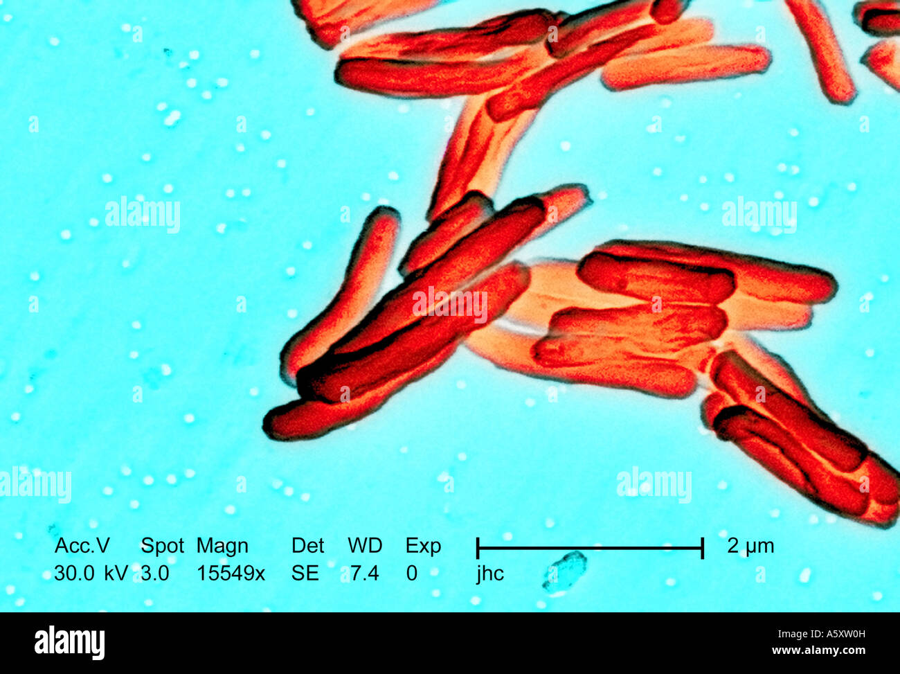 scanning Electron Schliffbild zeigt die Ultrastrukturforschung Details gesehen in der Zellwand Mycobacterium tuberculosis Stockfoto