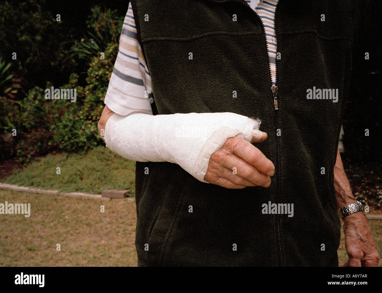 In gips gegossen Stockfotos und bilder Kaufen Alamy