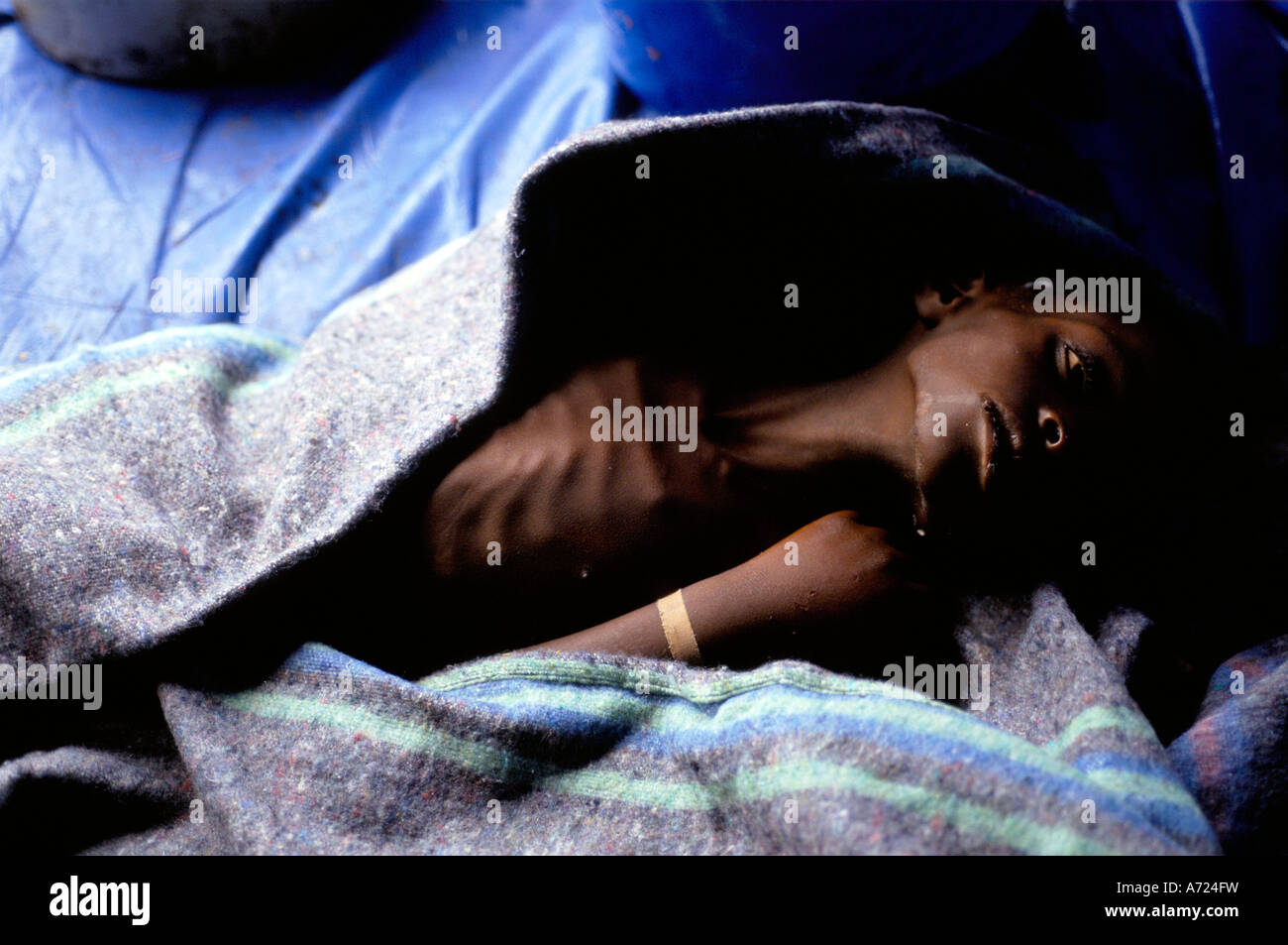 Ein junge leiden Ruhr liegt unter einer Decke in einer Klinik in das Lager Waisenhaus. Stockfoto