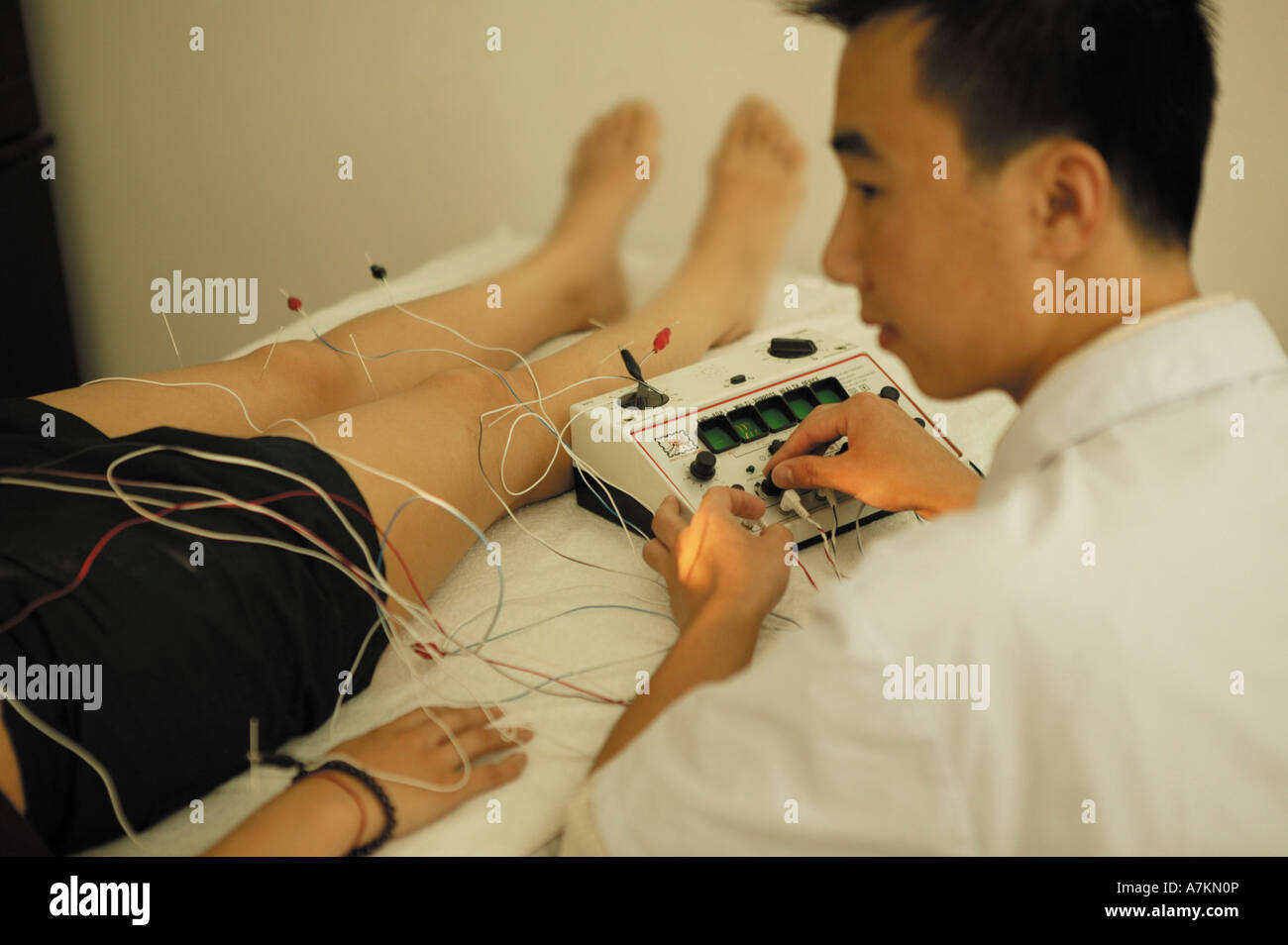 Chinesische Akupunktur Stockfoto