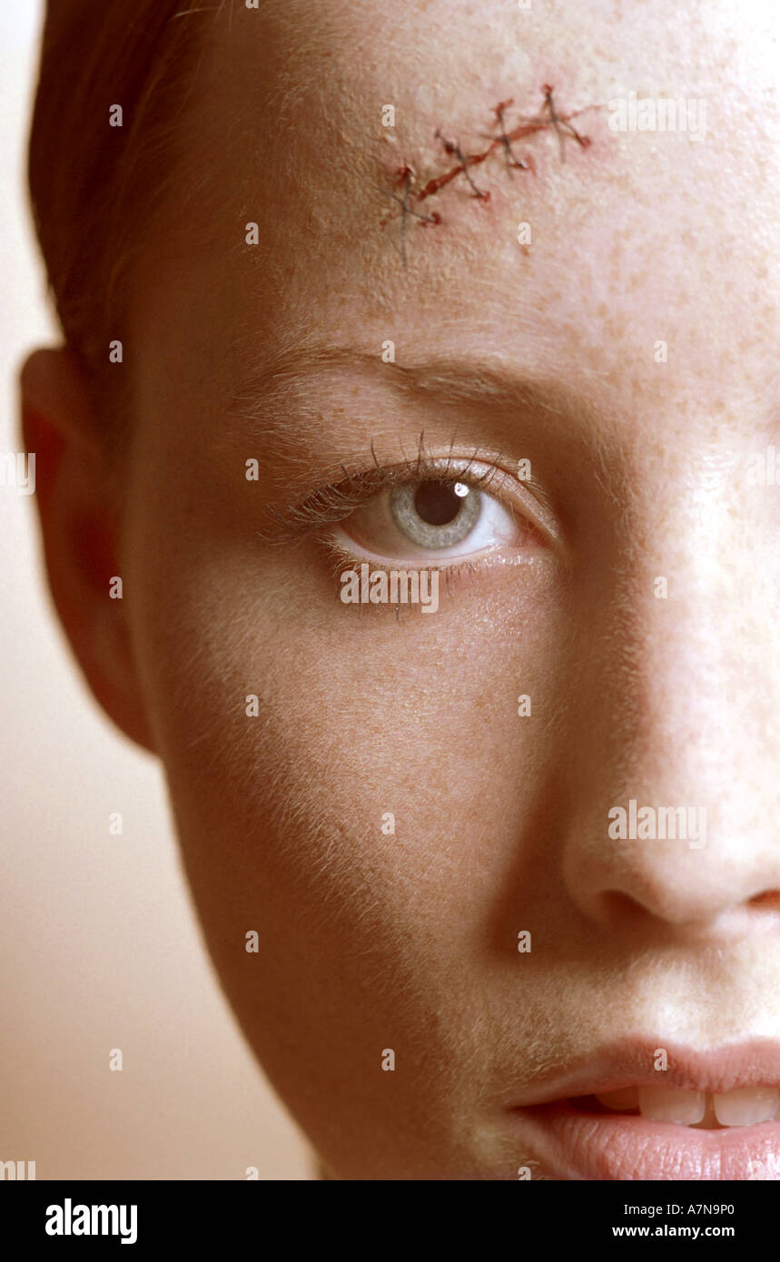Indoor Studio Frau Junges Madchen 25 Gesicht Fragment Halbe Sommersprossen Sommersprossen Braue Stirn Verletzungen Platzwunde Wunde Schnitt Naht Nahte Stockfotografie Alamy