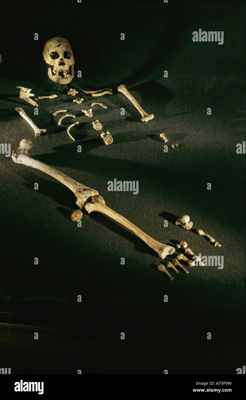 Georgien, Dmanisi, Composite Skelett von Einzelpersonen gefunden bei Homo Erectus, 1,8 Millionen Jahre alten Homininen Stockfoto