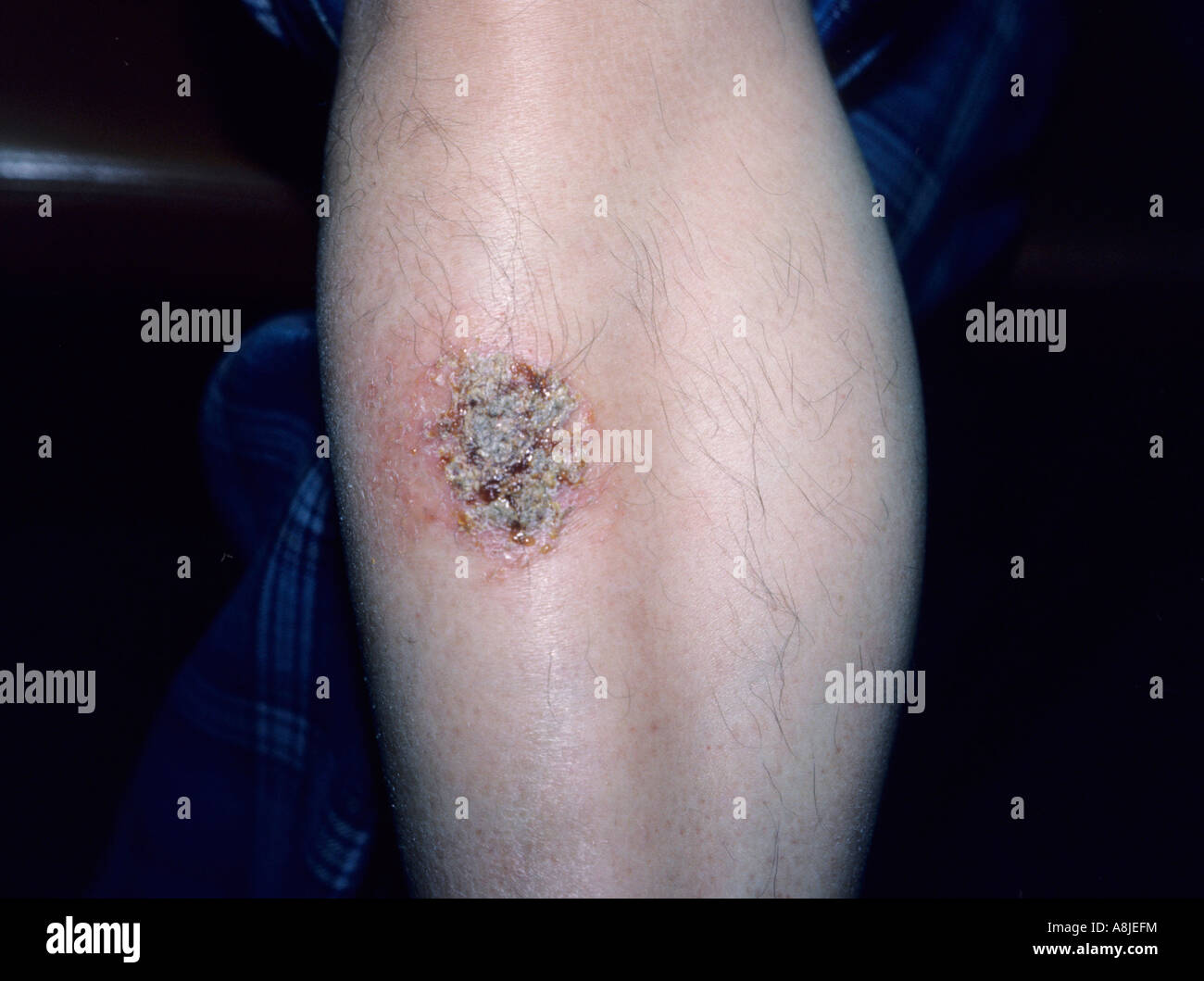Dermatology Cmsp Stockfotos &amp; Dermatology Cmsp Bilder Alamy