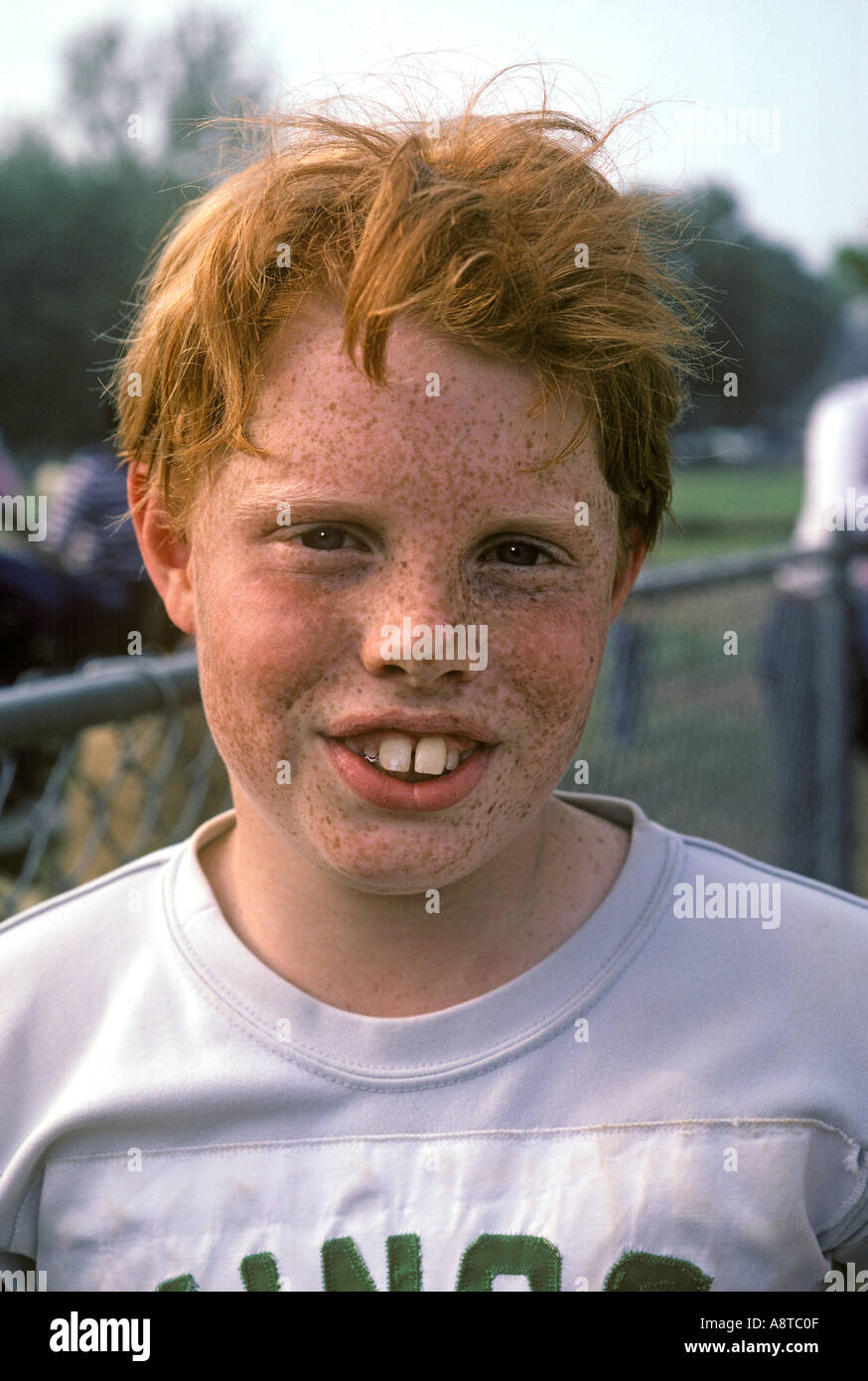 Sommersprossen-Boy Stockfoto