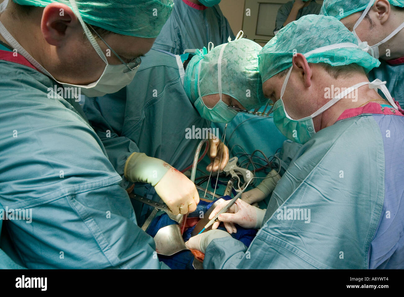 Chirurgen Bauchchirurgie Krebs Operation OP-Saal Stockfoto