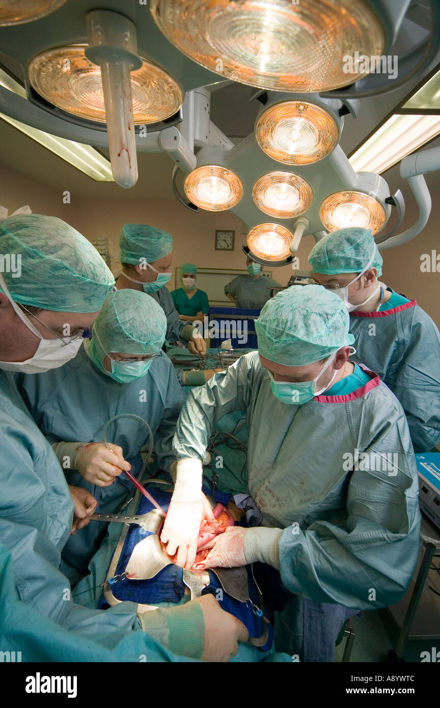 Chirurgen Bauchchirurgie Krebs Operation OP-Saal Stockfoto