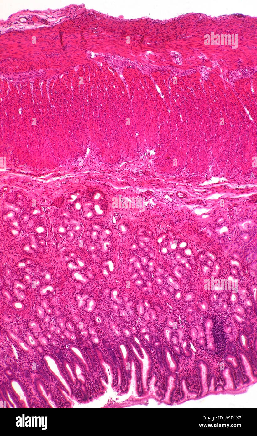 Menschlichen Pylorus Magen Abschnitt Mikrophotographie Stockfoto