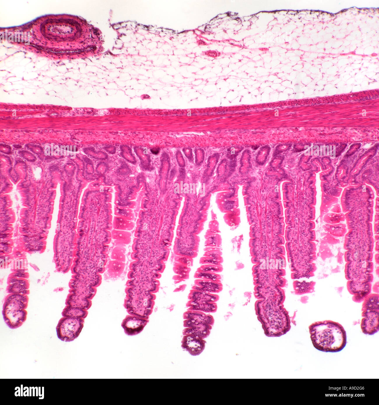 Menschlichen Dünndarm Abschnitt zeigt Villi, Hellfeld Mikrophotographie Stockfoto