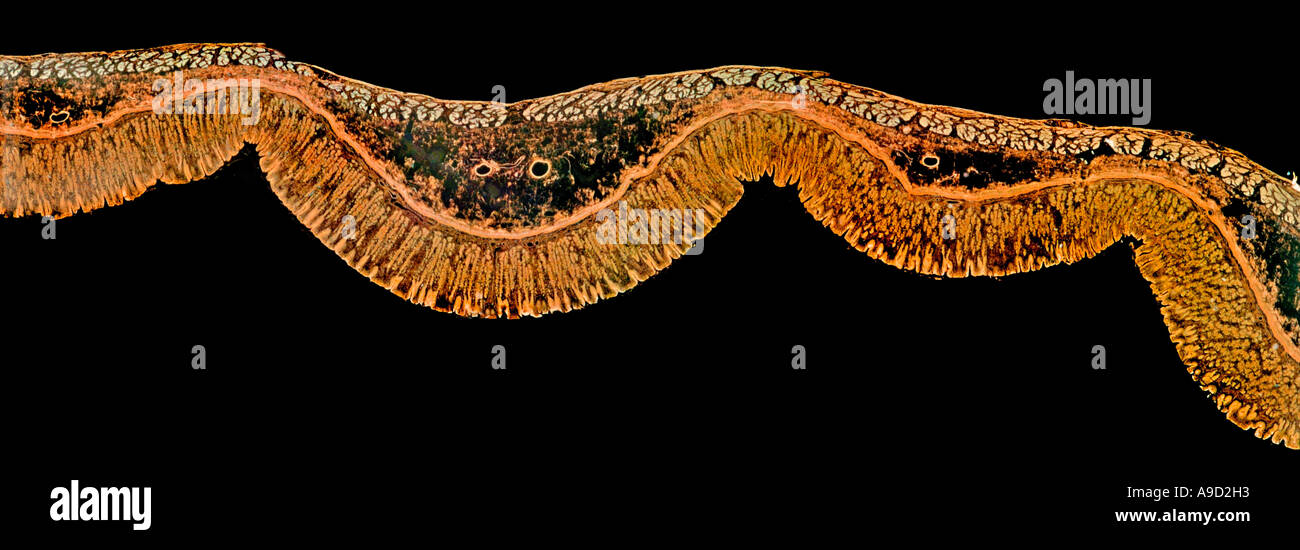 Menschlichen Magen Wand Mikrophotographie Dunkelfeld Stockfoto