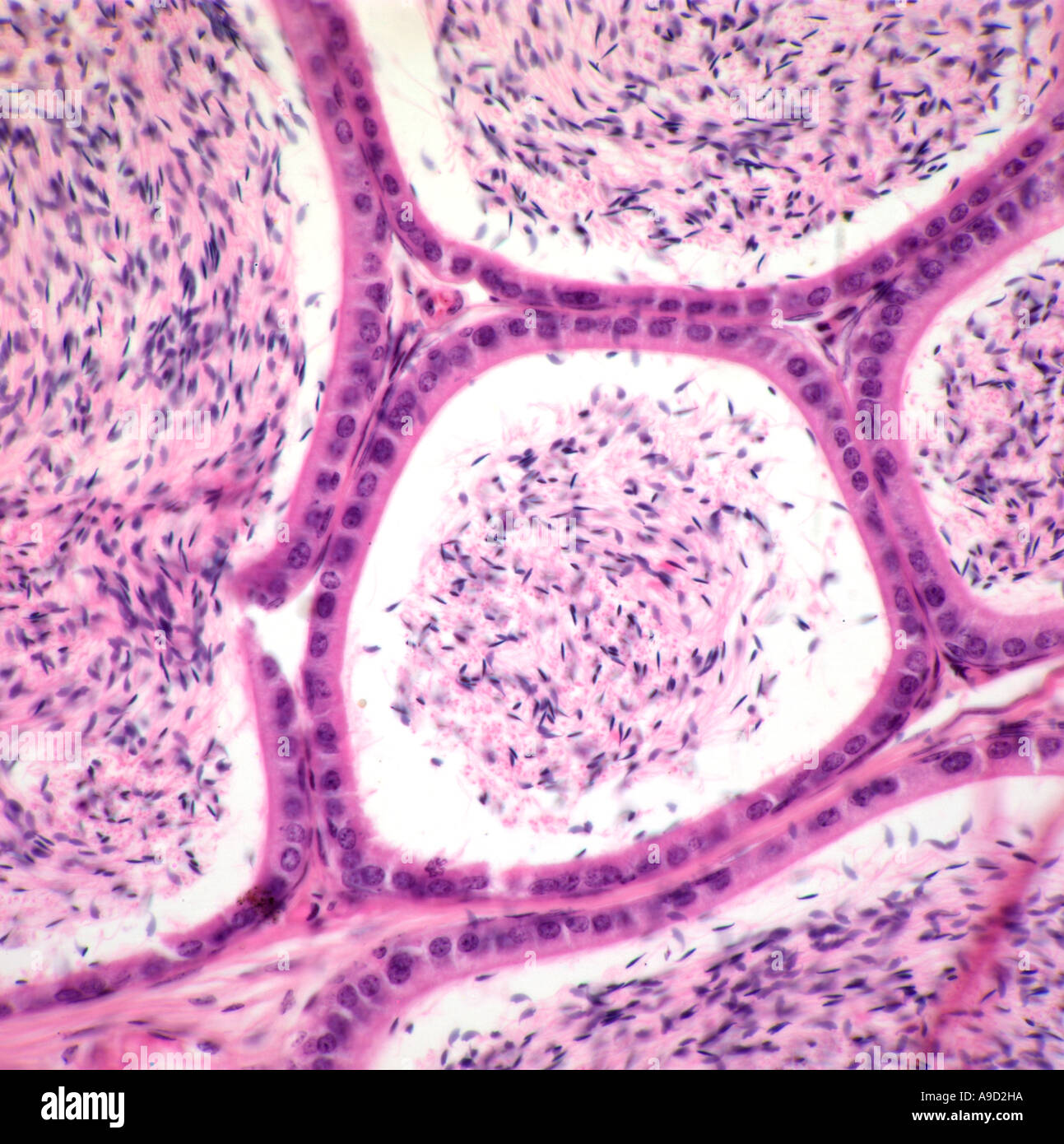 Menschliche Hoden Abschnitt, die Spematozoa Produktion Stockfoto