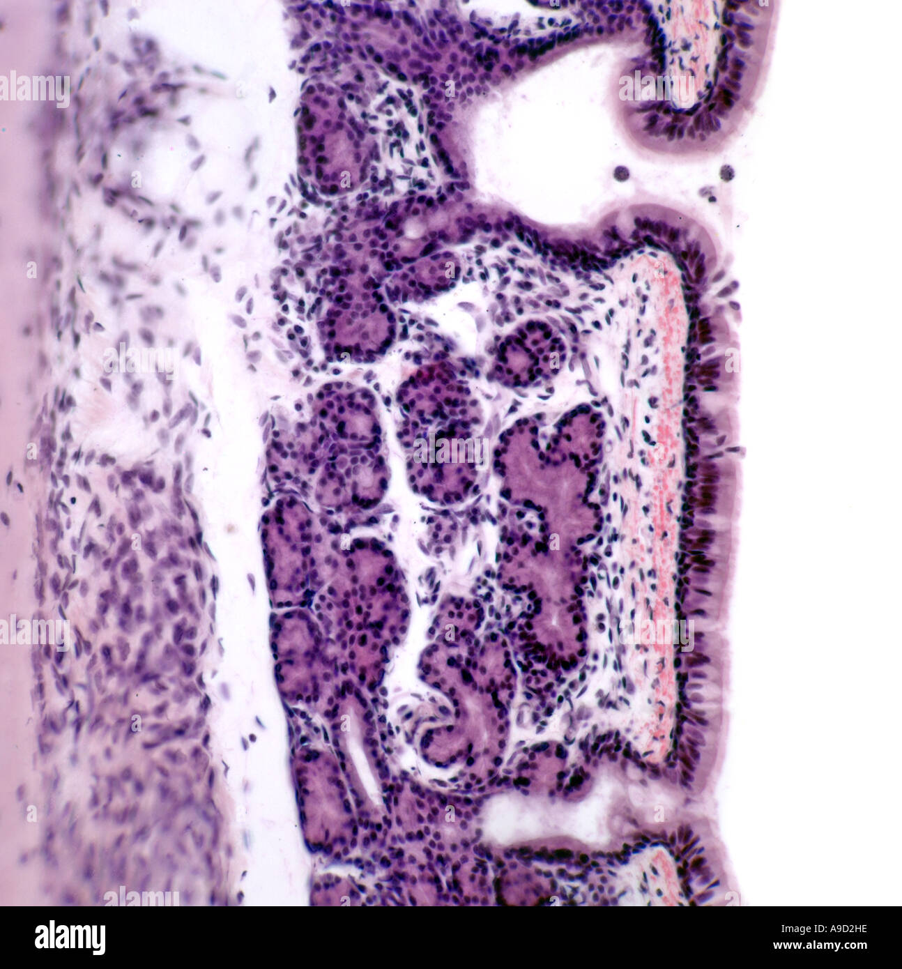 Menschliche Luftröhre Wand Mikrophotographie Stockfoto