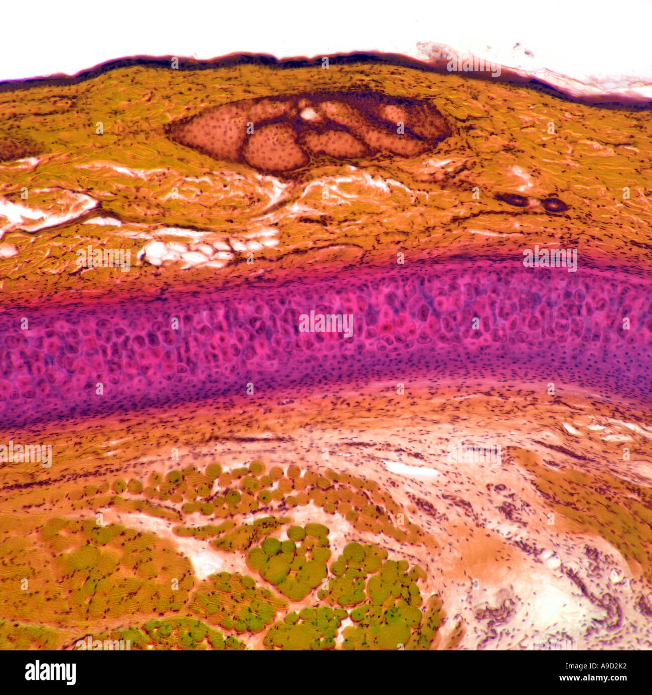 Menschlicher geschichteten Muskel, gelb gefärbten Mikrophotographie Stockfoto