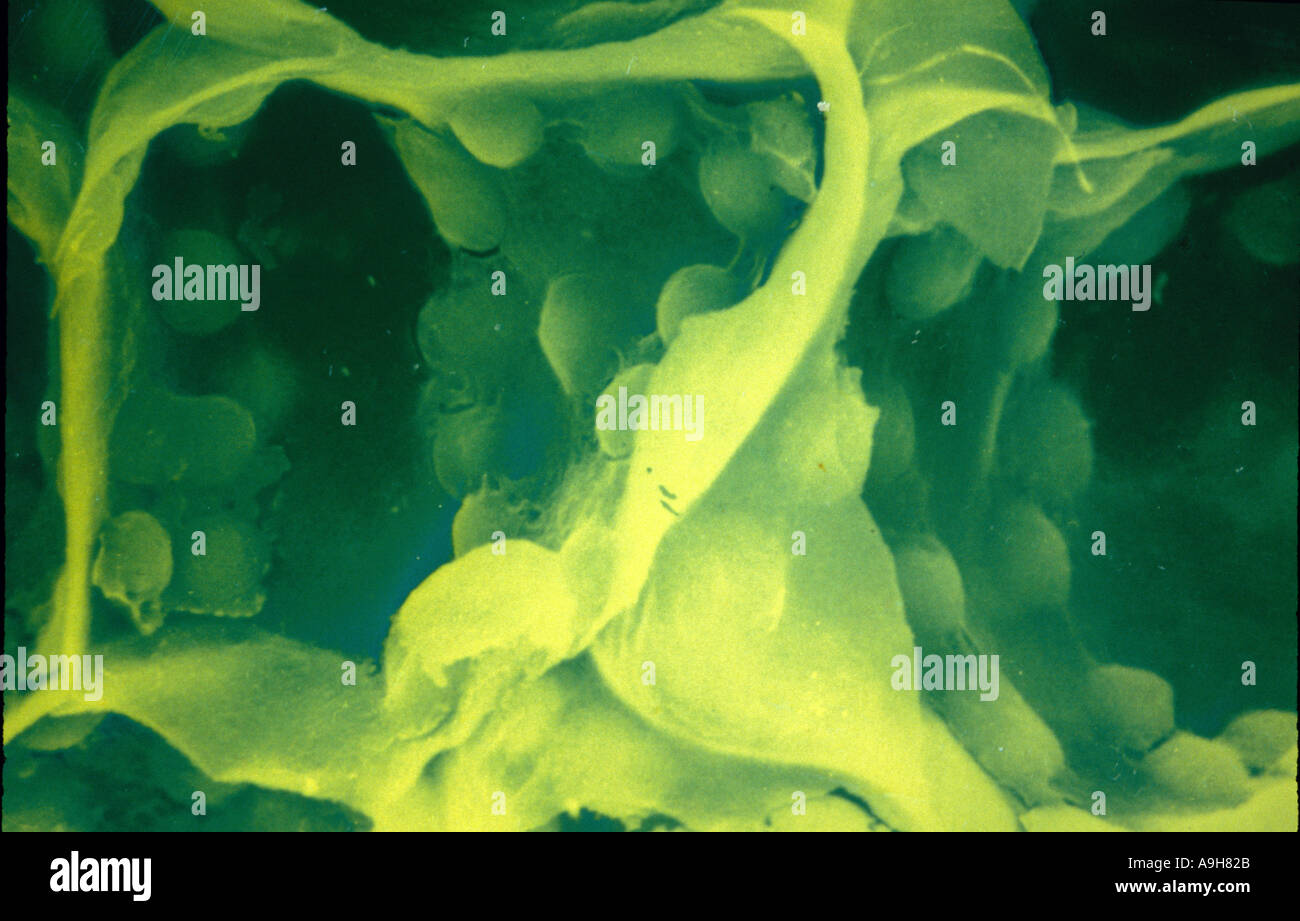 Wissenschaftliche SEM der Pflanzenzelle zeigt Chloroplasten und Zellwände Mag x 2190 1 95 9 33 Stockfoto