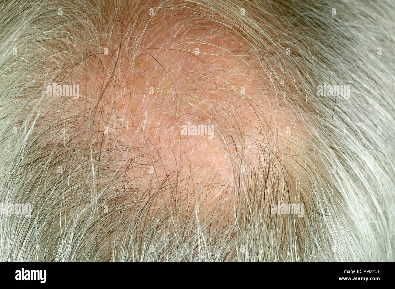 älterer Mann vertikale Nahaufnahme von hinten Glatze Stockfoto