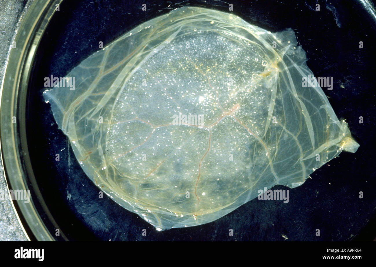 Hsv typ 2 Fotos und Bildmaterial in hoher Auflösung Alamy