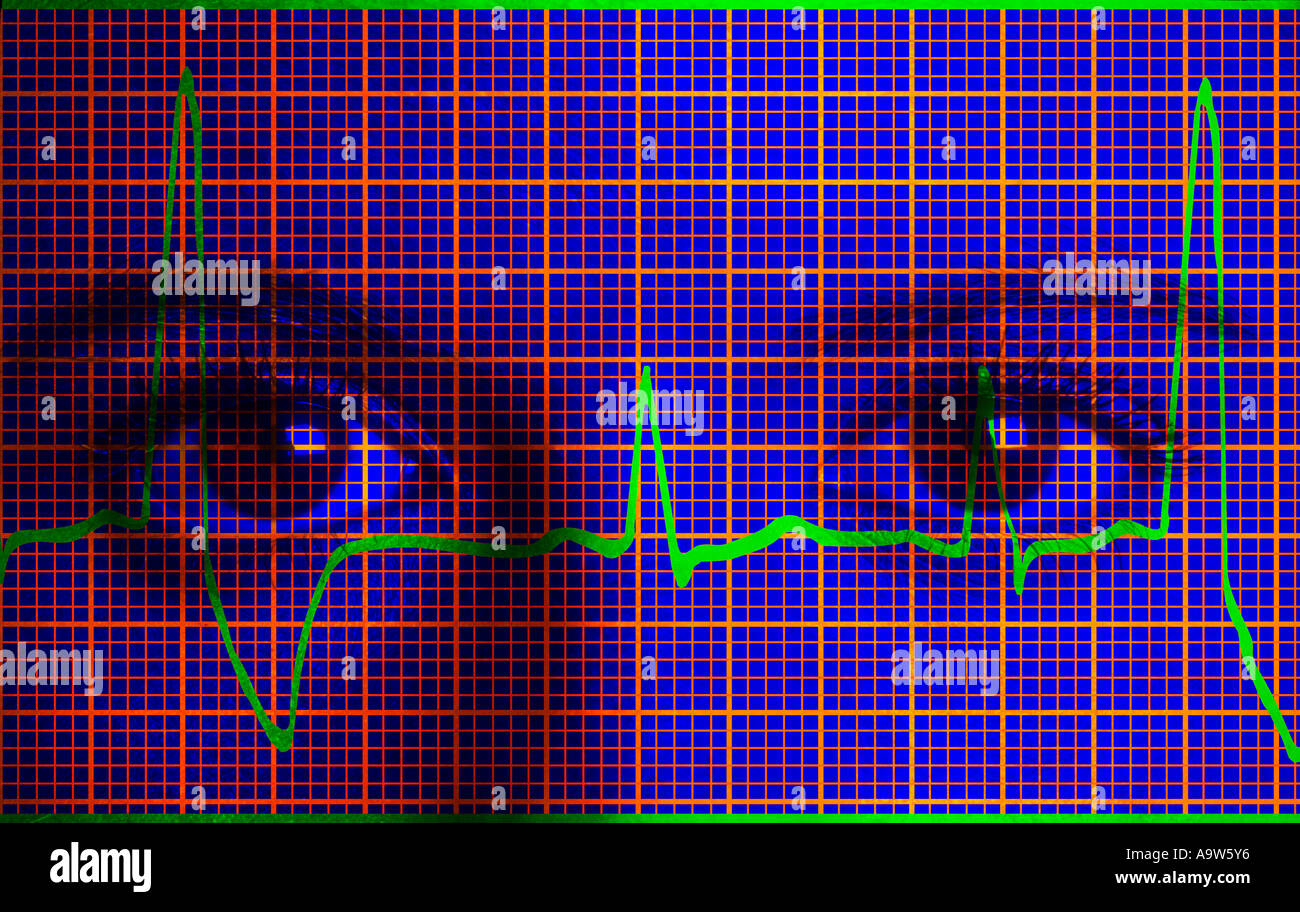 Closeup Konzept Bild von Frau Doktor mit Ausdruck der Elektrokardiogramm EKG Stockfoto