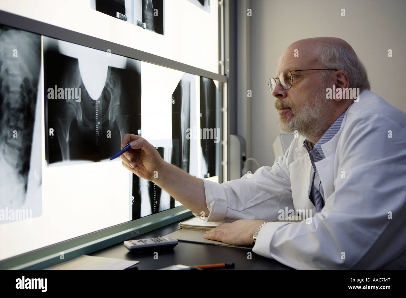 Altona s Kinderklinik Radiologen bei der Auswertung von Röntgenbildern Stockfoto