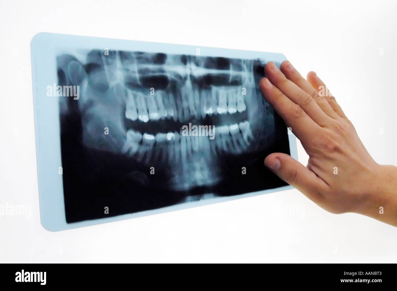 Zahnarzt dental X-Rays Prüfung Stockfoto