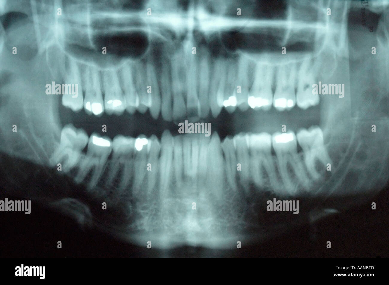 Dental X-rays Stockfoto