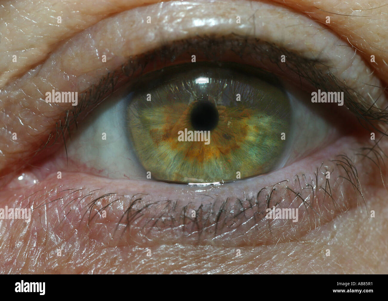 menschliches Auge, geschlossene Pupilla, Pupillen Reflex, Lichtreflex, Serie 2 von 2 Stockfoto