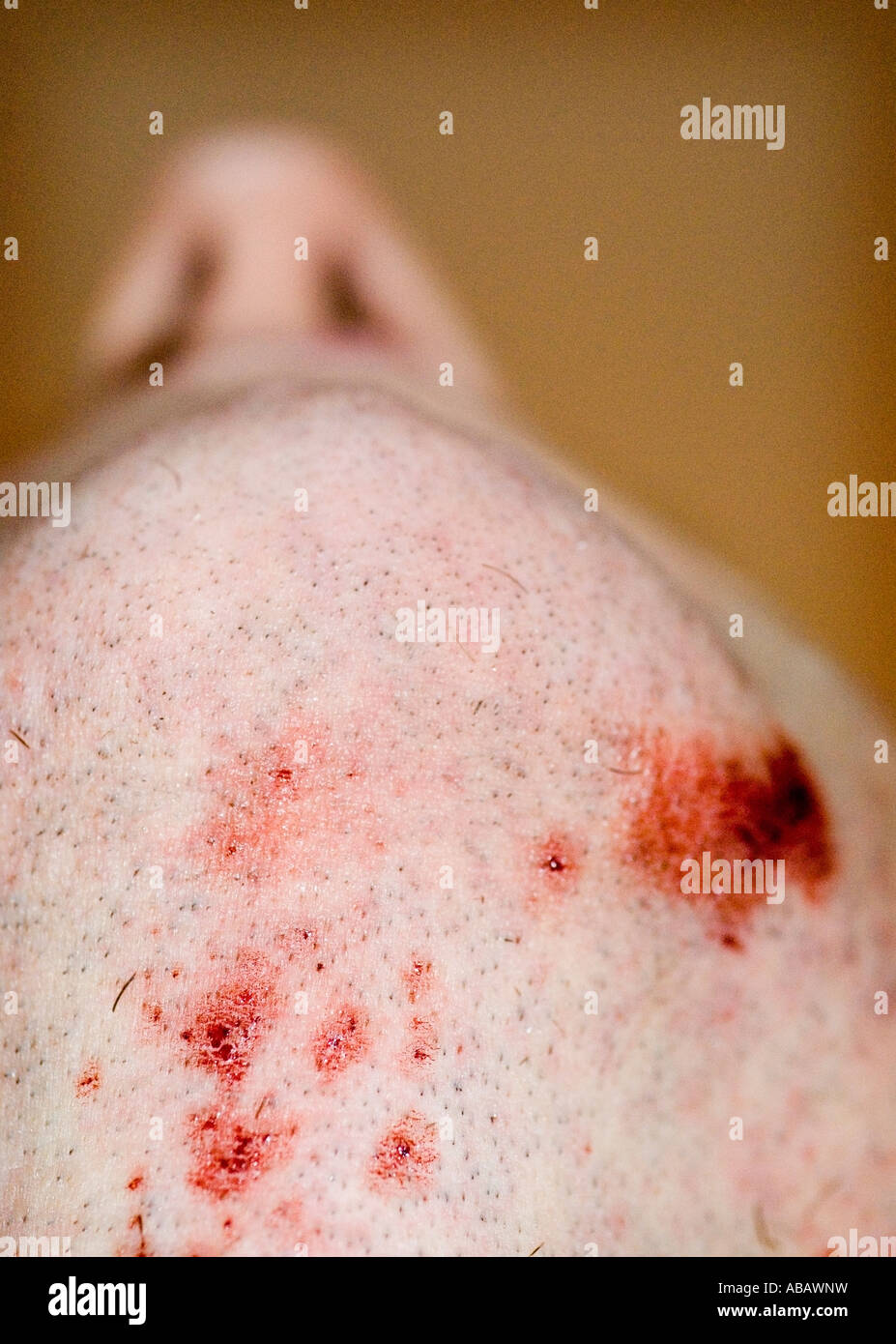 Blut Stockfotos und bilder Kaufen Alamy