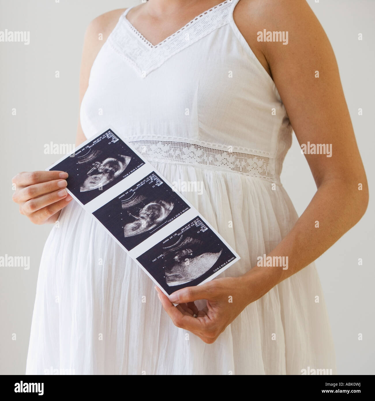 Schwangere Frau mit Ultraschall Ausdruck Stockfoto