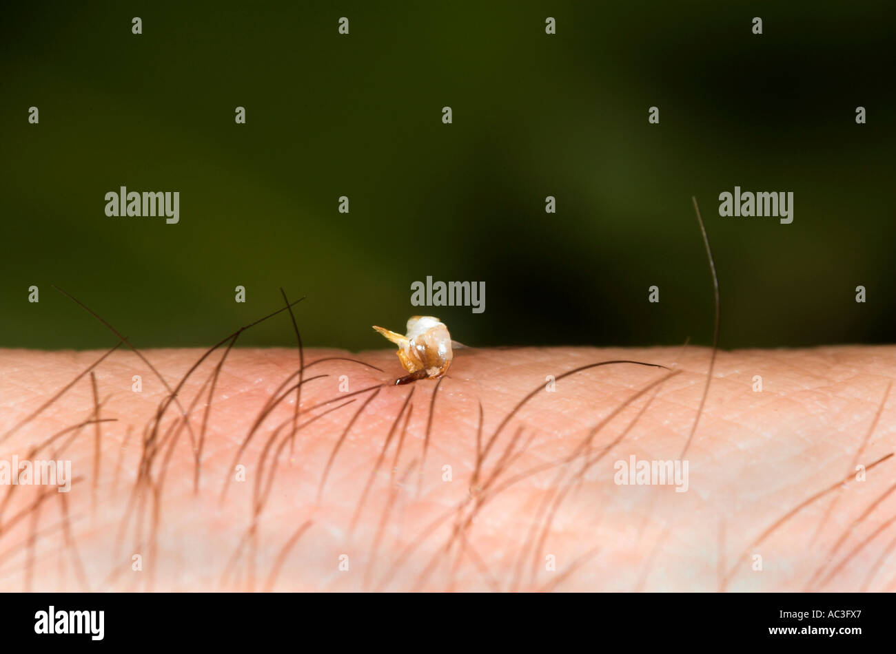 Honig Biene Apis Mellifera Stich von Biene in der hand zeigt stechende Teil und Bauch Vereinigtes Königreich Stockfoto