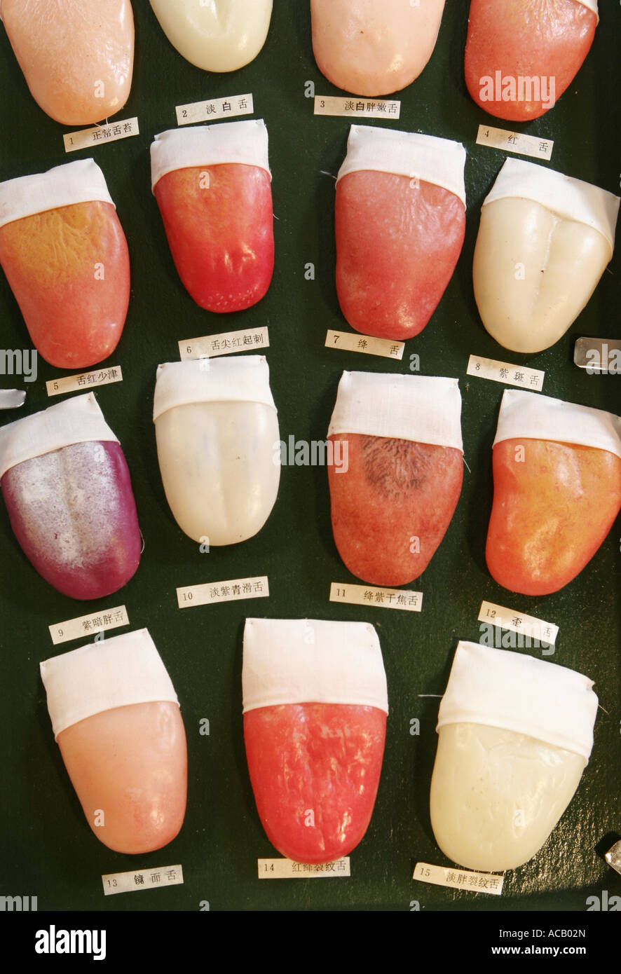 ZungeModelle für alternative Diagnostik Stockfotografie Alamy