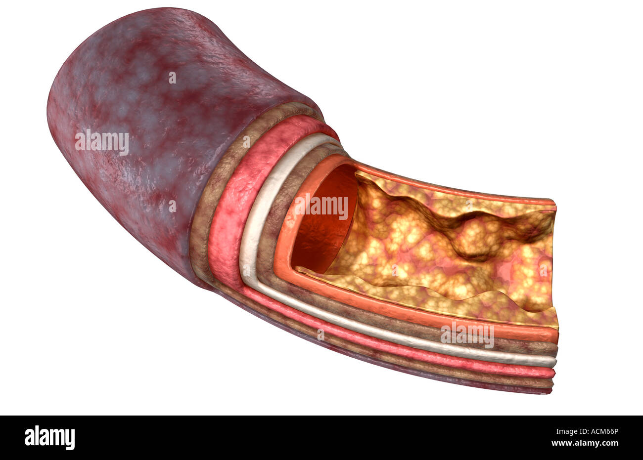 Die Arterienwand Stockfoto