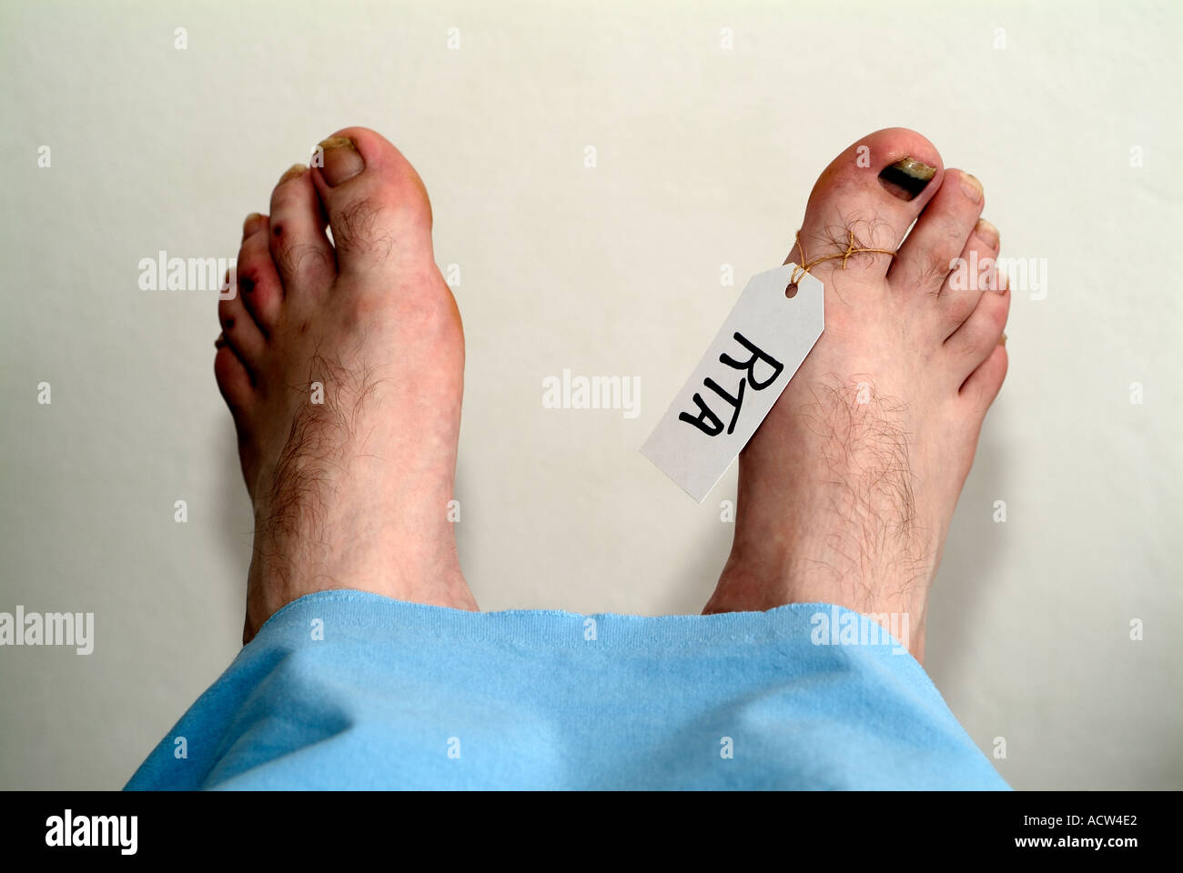 Füße von einem Toten Mans Körper in einer Leichenhalle nach einem tödlichen Autounfall. Stockfoto