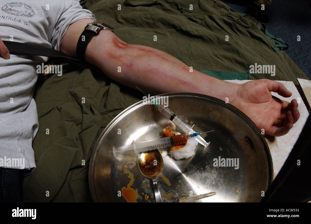 Ein Heroinabhängiger, der an einer Überdosis leidet, nachdem das Medikament durch eine hypodermische Nadel fixiert wurde (vom Modell gestellt) Stockfoto