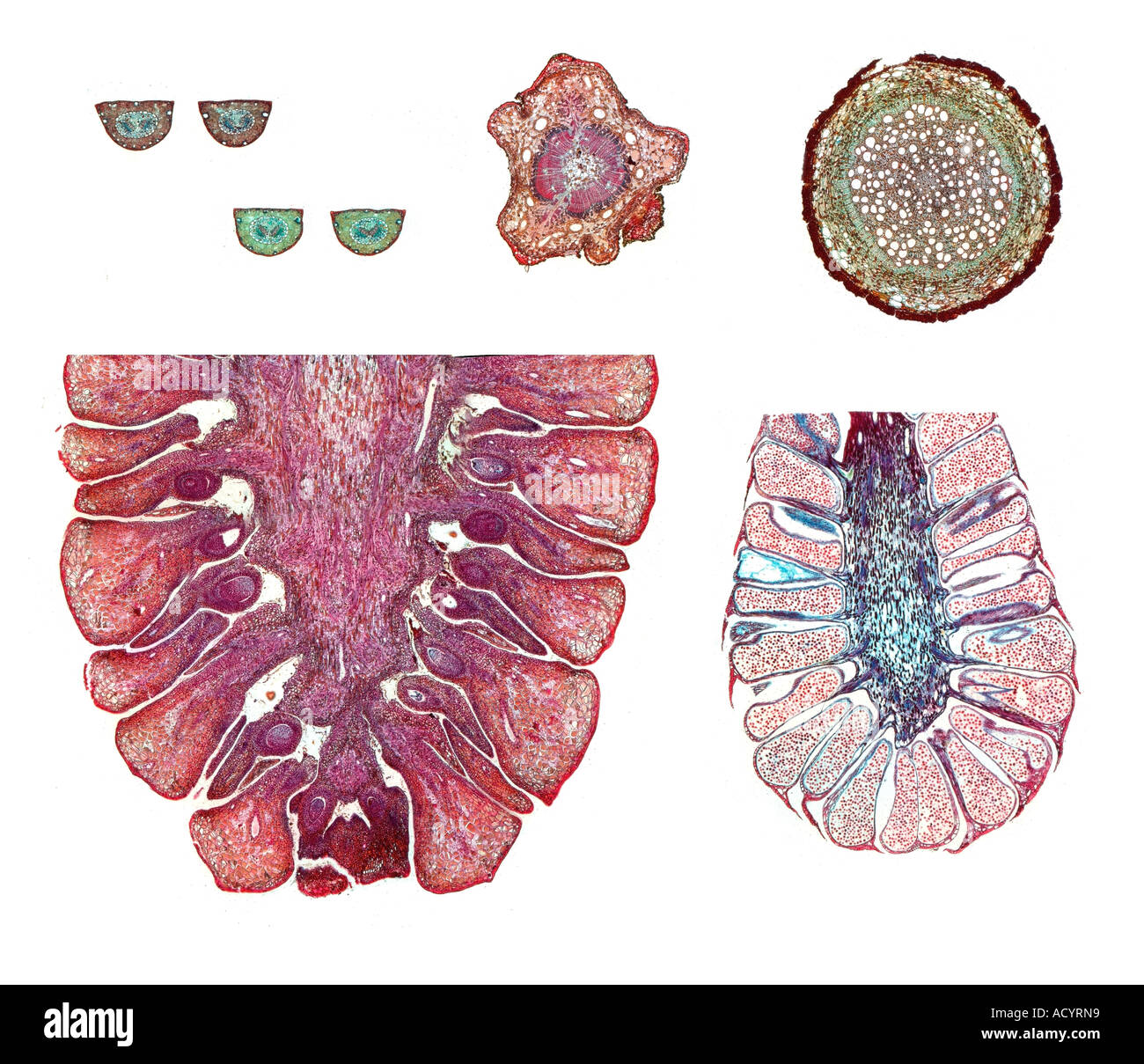 Kiefer Pinus SP. Auswahl an Mikroskop Dia Abschnitte zeigen Struktur aus verschiedenen Teilen der Pflanze Stockfoto