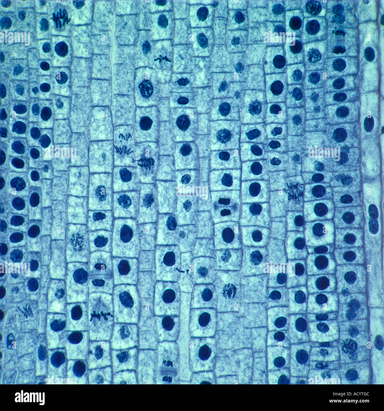 Mitose-Zellteilung in Wurzelspitze der Zwiebel. Gefärbten Objektträger Abschnitt, Hellfeld Mikrophotographie Stockfoto