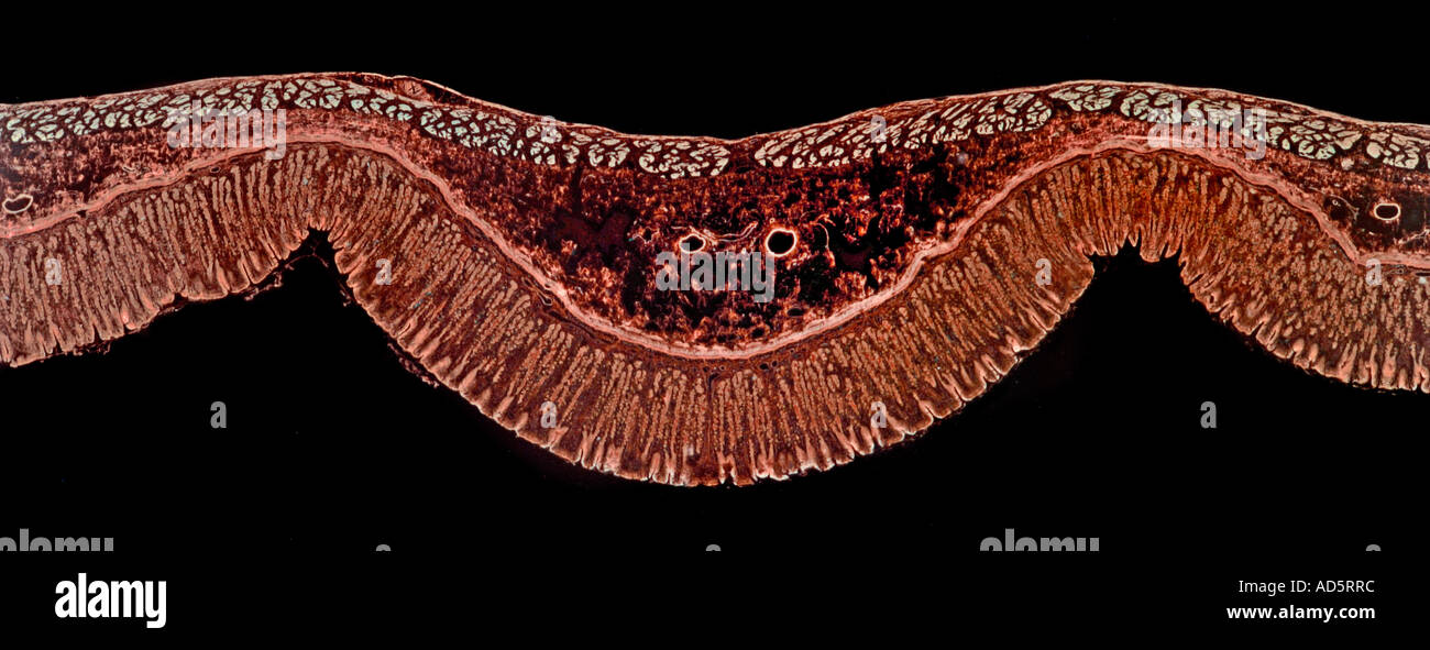 Magen-Pinnwand zeigt allgemeine Struktur, Dunkelfeld Mikrophotographie Stockfoto