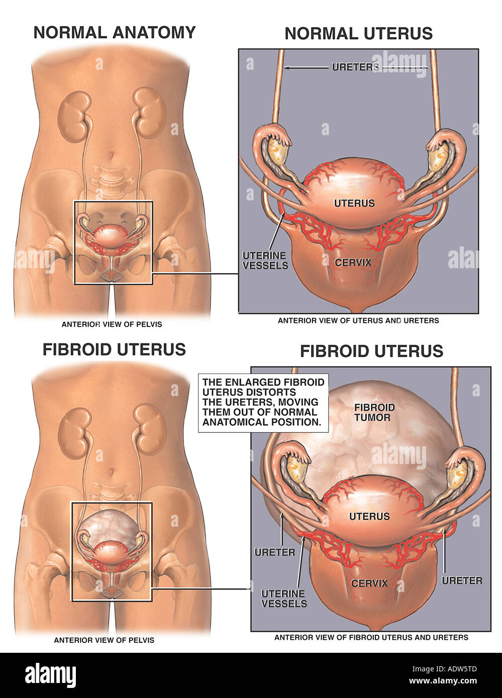 Aus gebärmutter sieht wie gesenkte eine Gebärmutterschleimhaut Tabelle: