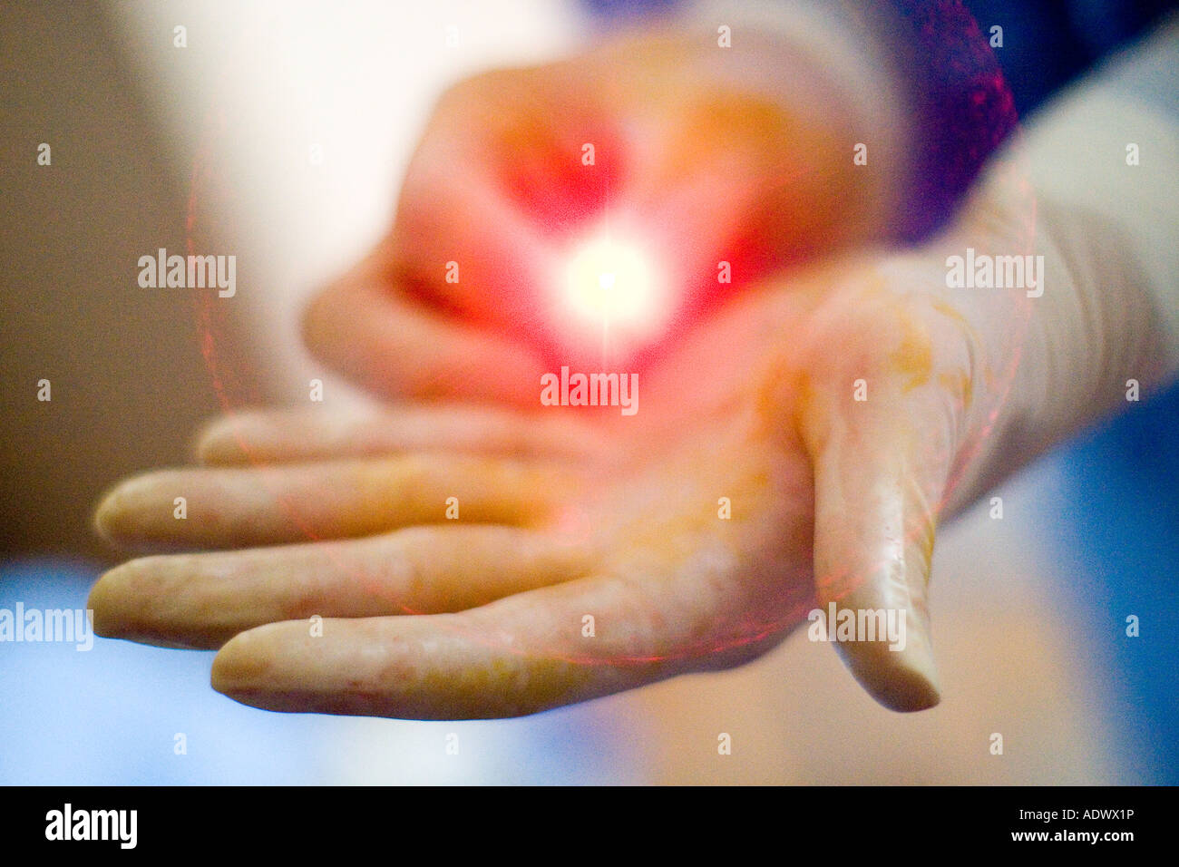 Arzt halten eine Laserfaser verwendet für Vene Ablation bei Behandlung von Krampfadern Stockfoto