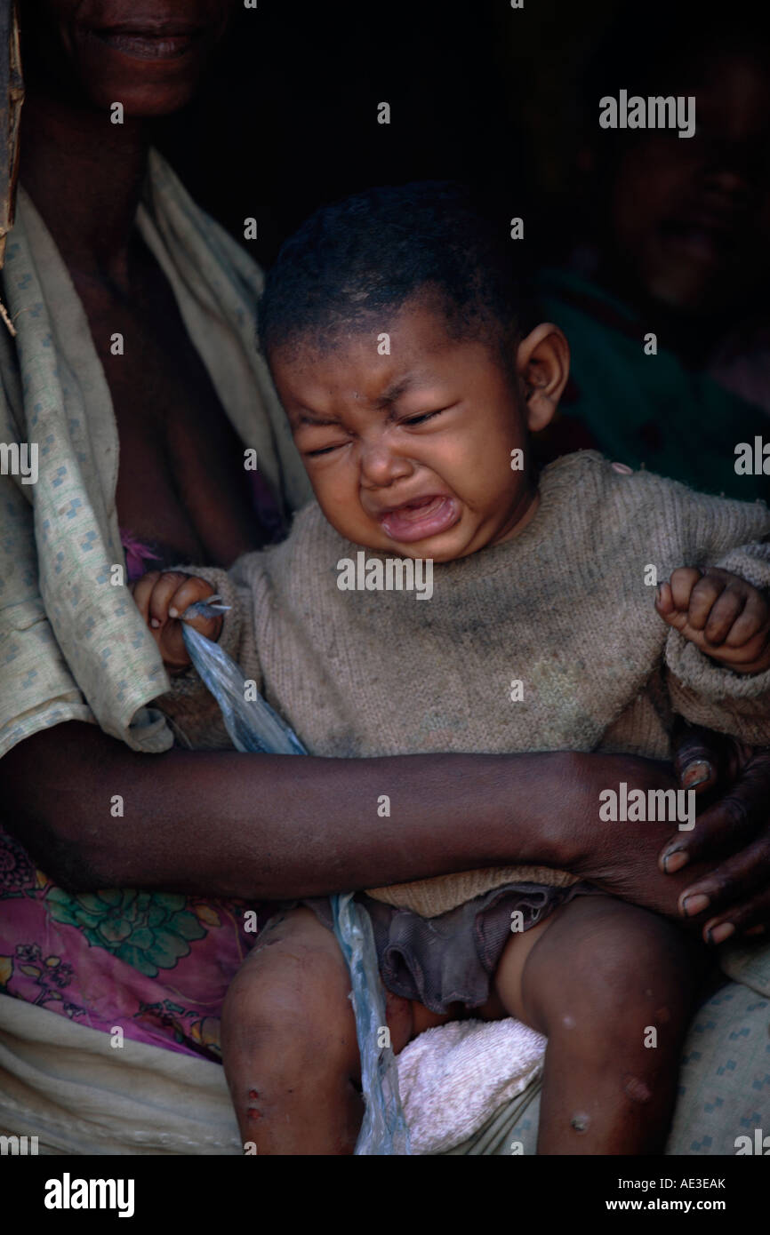 Kleines Kind in Evatra Dorf, Madagaskar Stockfoto