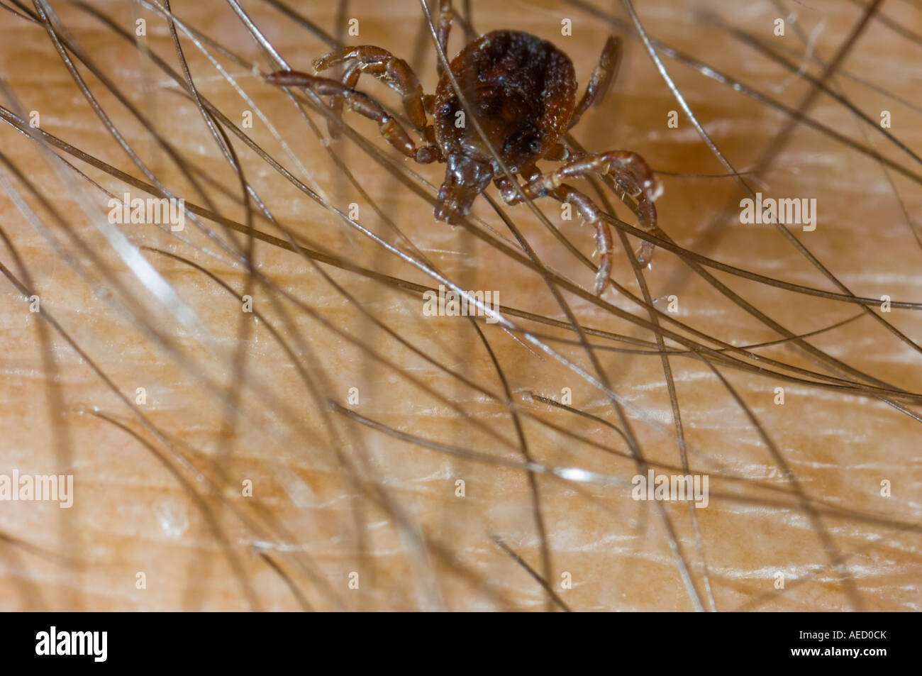 Zecke (Hyalomma Lusitanicum) am menschlichen Arm, Spanien Stockfoto