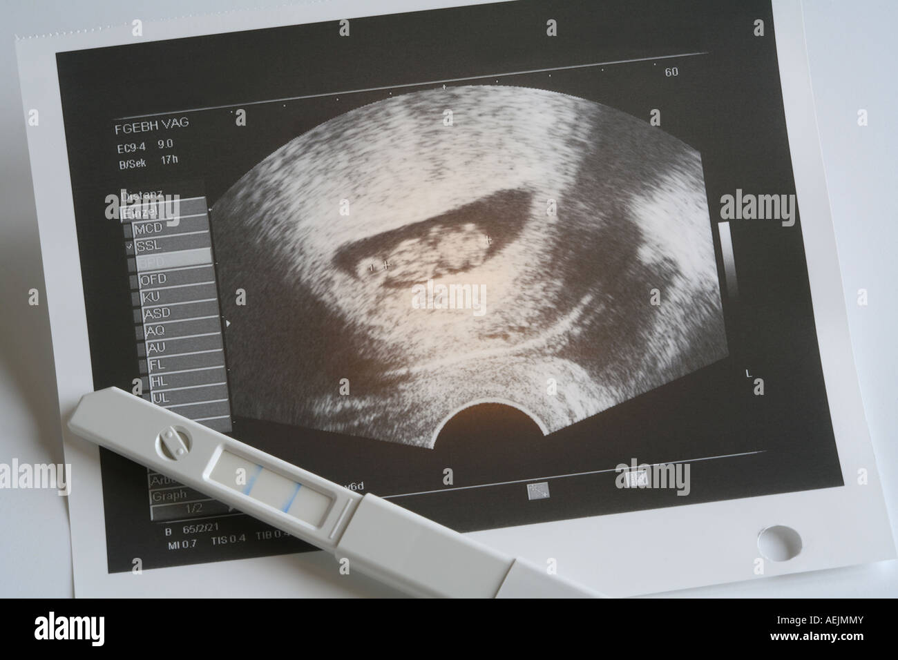 Positiven Schwangerschaftstest Ergebnis, Ultraschall Bild eines Fötus in der neunten Woche der Schwangerschaft Stockfoto