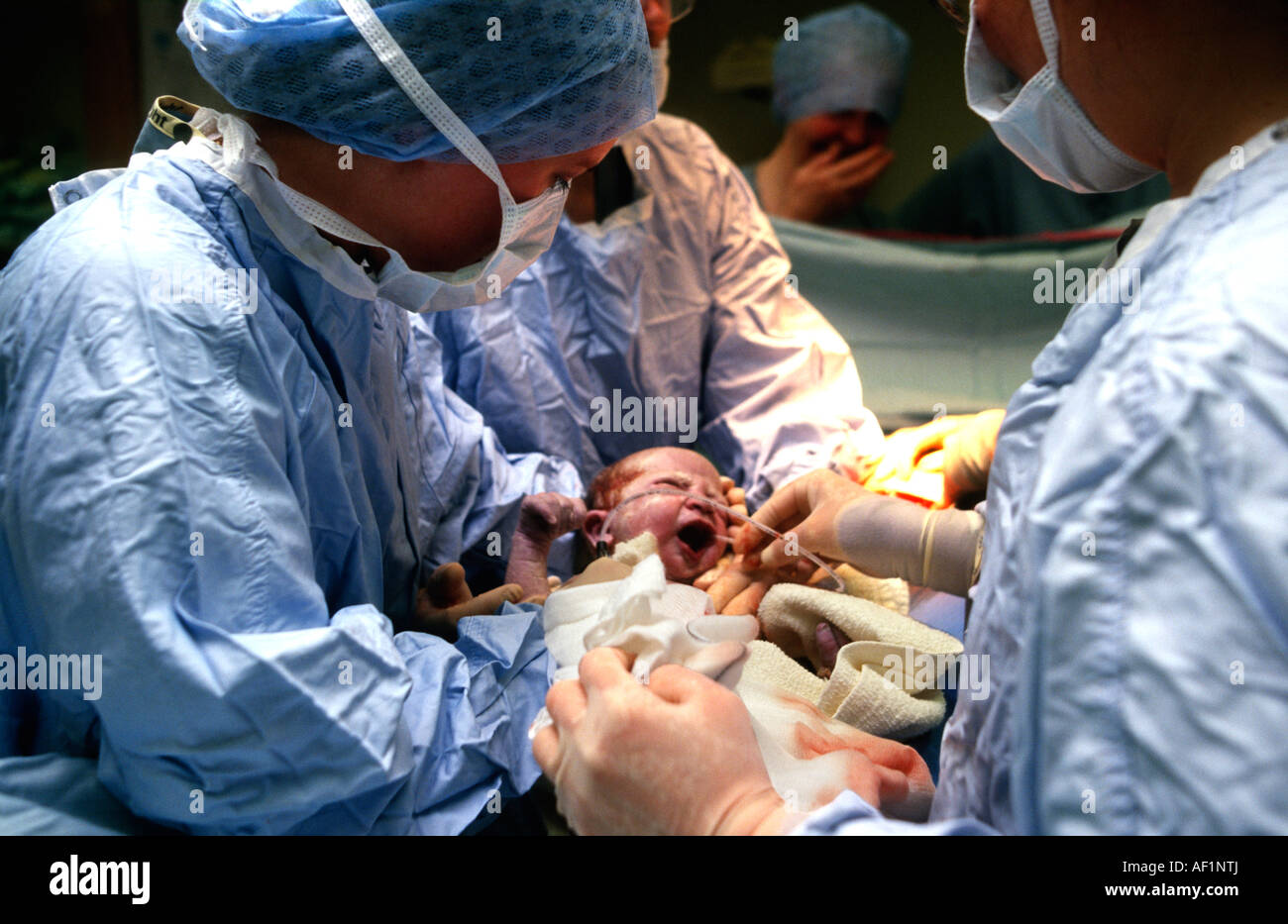 Absaugen, Schleim von Neugeborenen nach Kaiserschnitt Geburt  Stockfotografie - Alamy