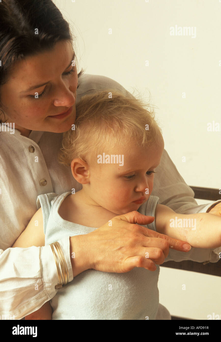 Kind Mit Hautausschlag Fotos Und Bildmaterial In Hoher Auflösung Alamy 