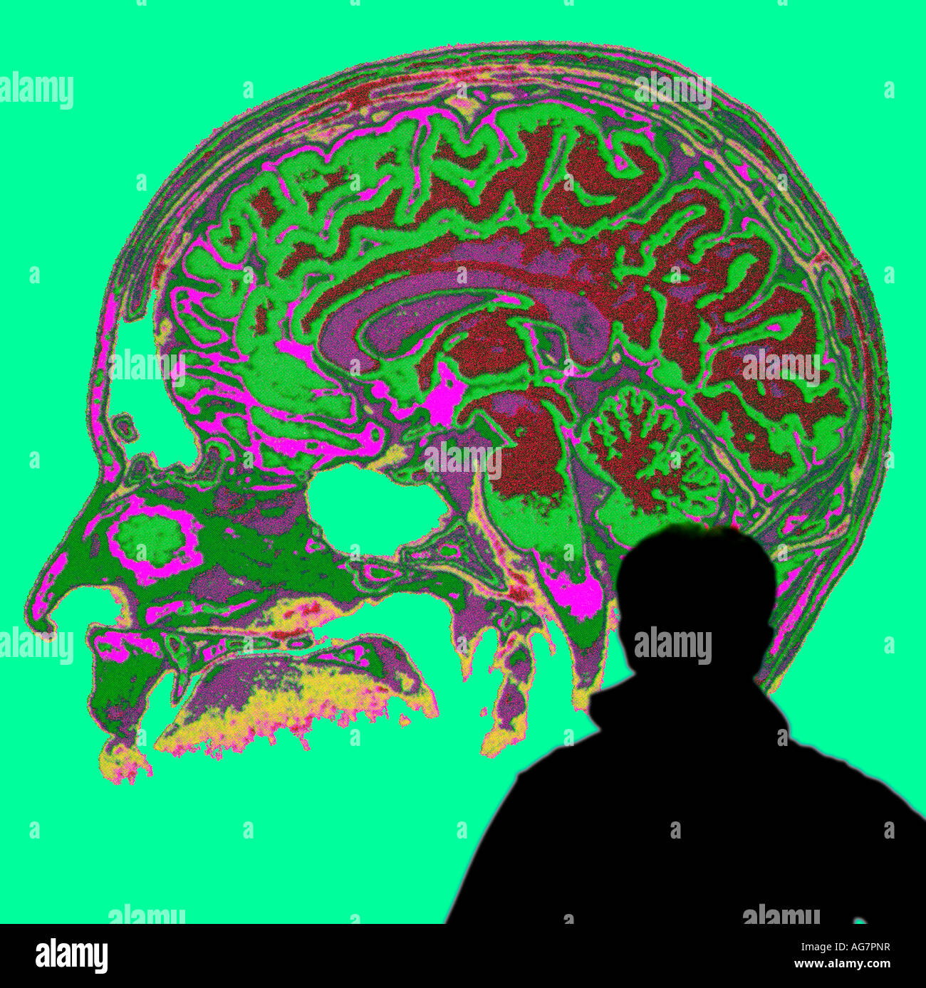 Doktor der Medizin studieren projizierte Ansicht des menschlichen Gehirns Stockfoto