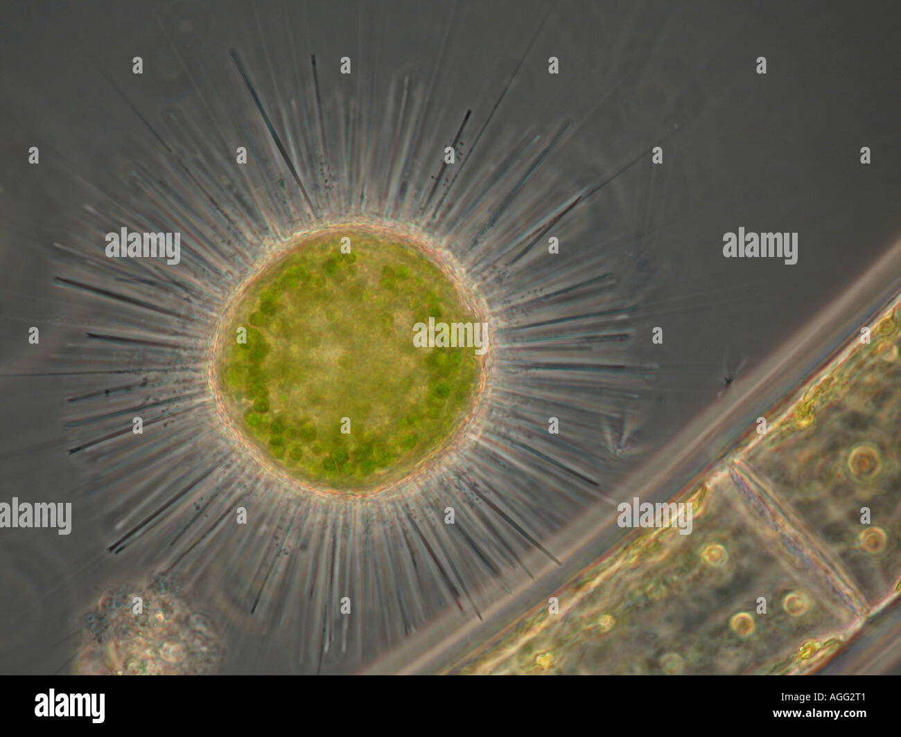 Acanthocystis Turfacea (Acanthocystis Turfacea), mit dem Phasenkontrast-MRT Stockfoto