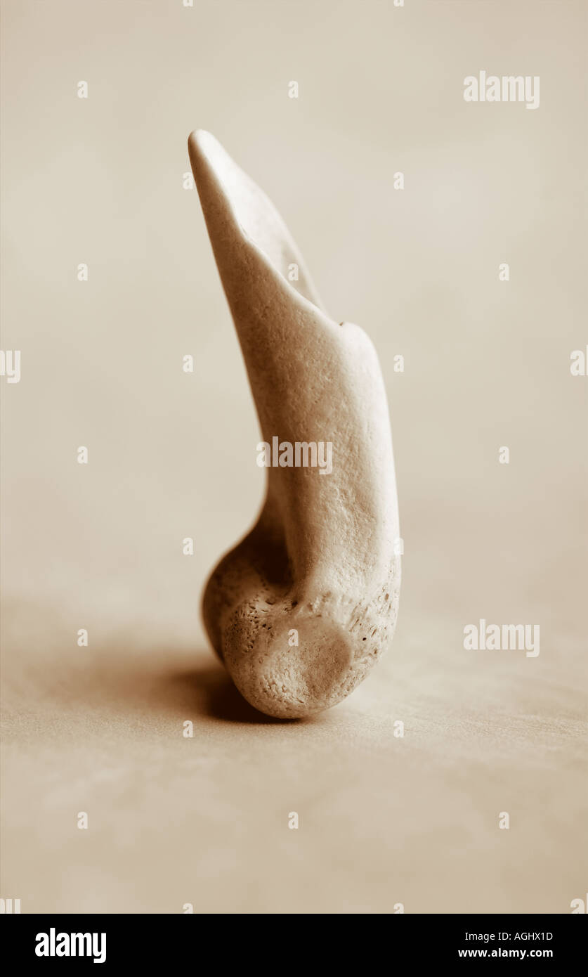 getragen von gebrochenen Knochen Stockfoto