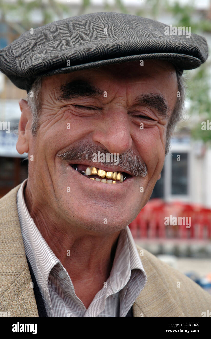 Porträt des Mannes mit Goldzähnen im Dorf in der Türkei. Stockfoto
