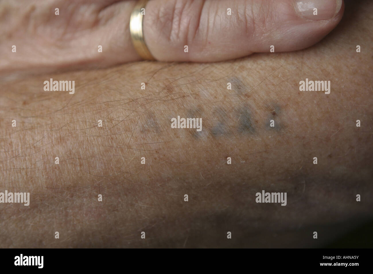 Auschwitz-Überlebender Eva Schloss zeigt Tattoo auf arm Stockfoto