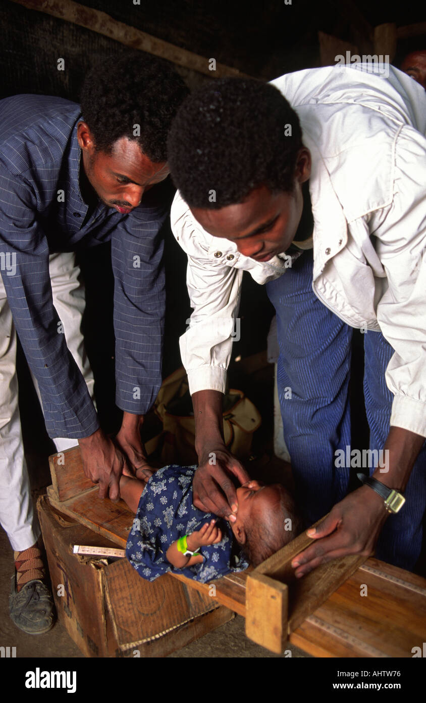 Gesundheitsarbeiter messen ein unterernährt somalischen Flüchtling Baby. Ostäthiopien Stockfoto