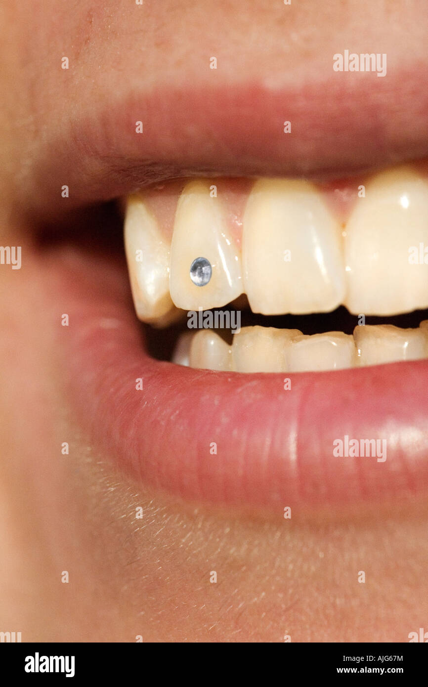 Diamond teeth -Fotos und -Bildmaterial in hoher Auflösung – Alamy